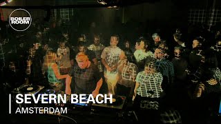 Photo of set Severn Beach.